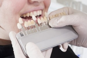 dental-bridge-lakeway-cosmetic