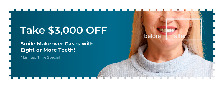 Take $3,000 off smile makeover cases with eight or more teeth. Limited time special. Image of smiling woman with a before-and-after box highlighting her teeth.